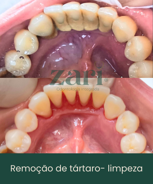 Subcabeçalho (11)