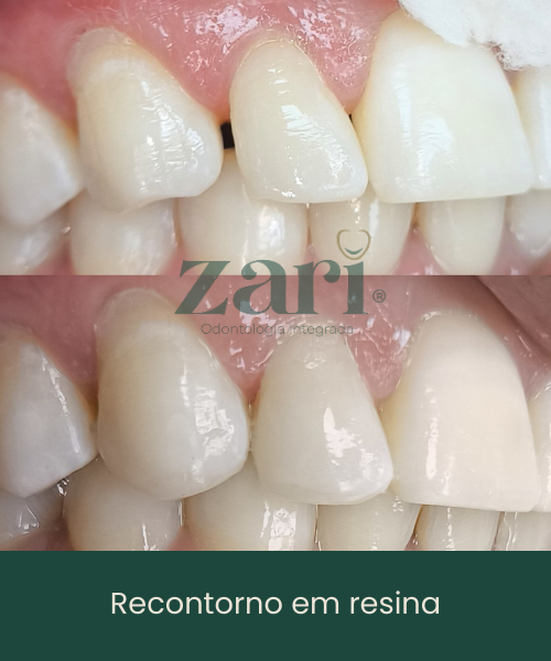 Subcabeçalho (12)