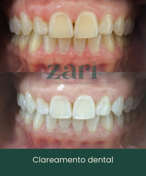Subcabeçalho (13)