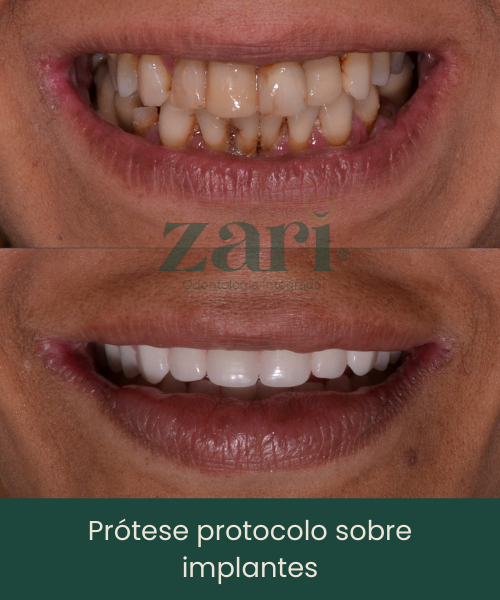 Subcabeçalho (16)