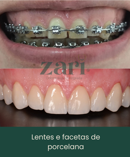 Subcabeçalho (17)